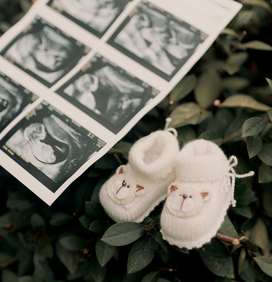 Plusieurs images d'écographies de bébé, avec des petits chaussons blancs posés sur des feuilles vertes