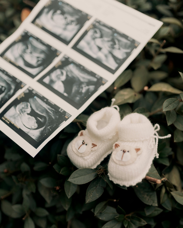 Plusieurs images d'écographies de bébé, avec des petits chaussons blancs posés sur des feuilles vertes