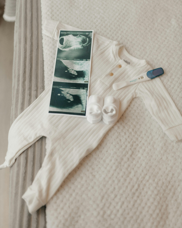 Body blanc avec petits chaussons bébé dessus, un test de grossesse positif et une écographie de bébé, sur un drap de lit blanc 