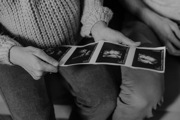 Placenta antérieur, bas, accreta : comprendre la position du placenta